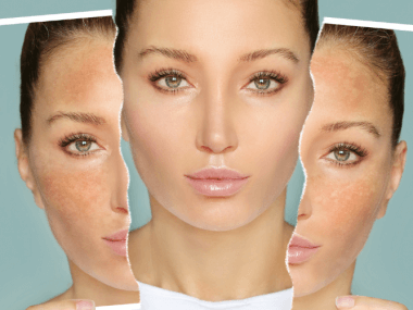 No todas tenemos el mismo tipo de piel por lo que es indispensable conocerlo para poder aplicar los productos adecuados.