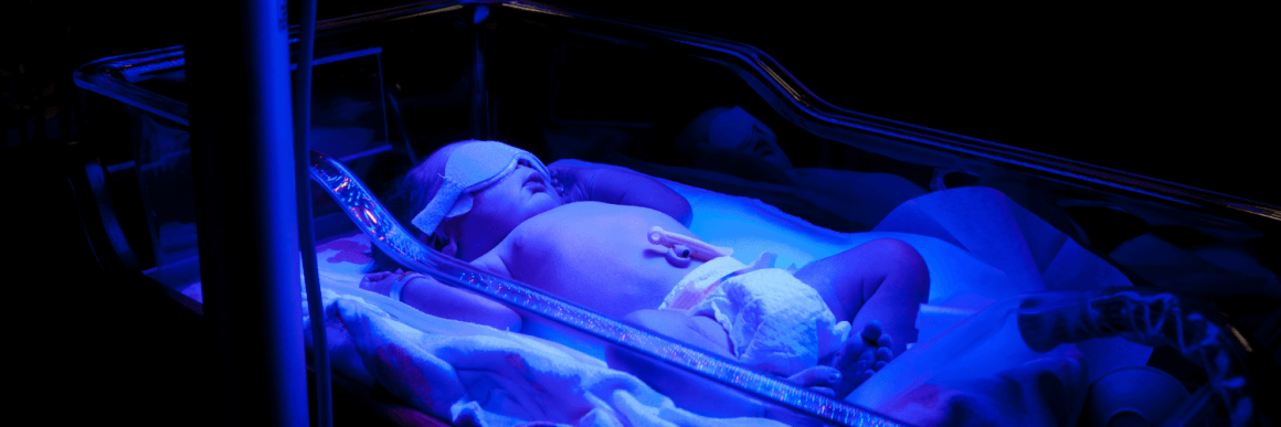 Фототерапия для новорожденных при желтухе. Лампа от желтухи над кроватью. Цвет полости рта при желтухе неонатальной. Чем закрыть глаза новорожденному под лампой от желтухи.