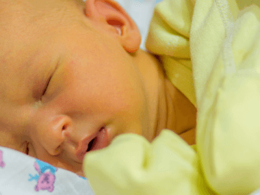 Aprende sobre la ictericia neonatal, los riesgos del exceso de bilirrubina y cómo la fototerapia salva vidas en México