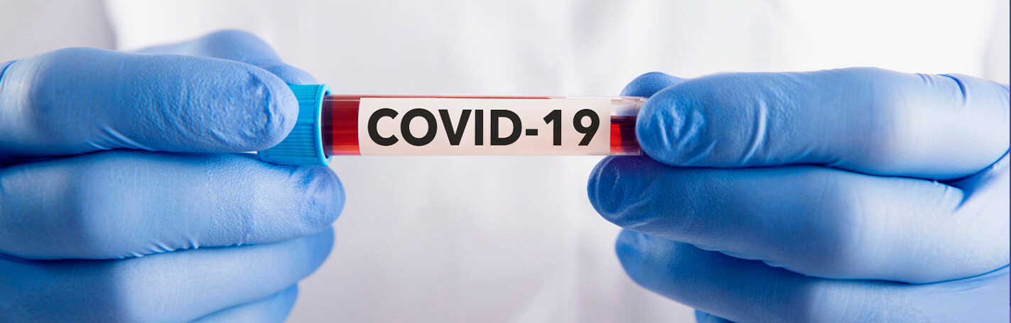 IRIS es la nueva variante del Covid-19 que ya se encuentra en alrededor de 50 países y ha ido aumentando rápidamente en número de contagios.