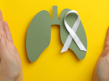 Un paso adelante en el tratamiento del cáncer de pulmón en México