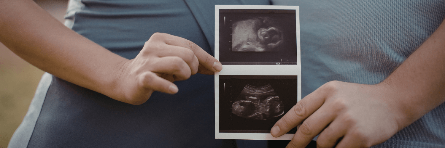 Pareja embarazada abrazada y sonriendo, representando la conexión emocional y el bienestar en el embarazo